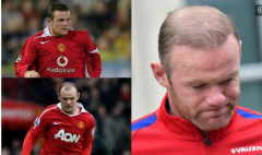 哪些足球明星需要迫切做植发 重塑发型风采（一）