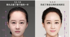 女神和女汉子就差发际线这点事，该种就种！！！