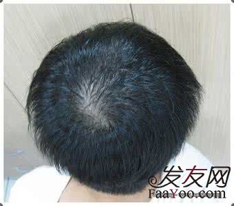 使用增发纤维有什么危害?