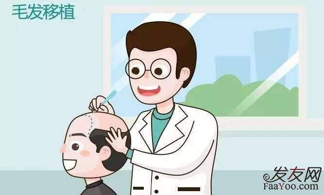 植发不能治疗的脱发有什么？　