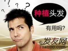 植发治疗脱发效果好吗？