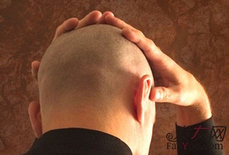 植发后的护理方法有什么?