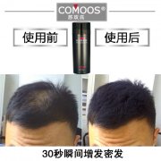苏正解读：秃顶，掉发，脱发应该如何解决？