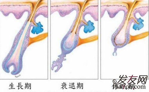 植发后头发都会经历过什么效果怎么样？　