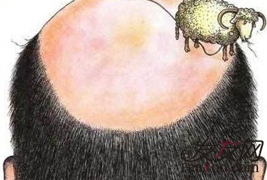 能使用他人头发植发吗?