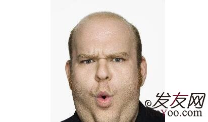 植发前需要了解什么?