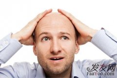 能够治疗脱发的方法都有什么呢？