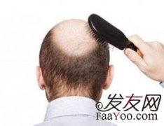 脱发造成的原因都有什么？