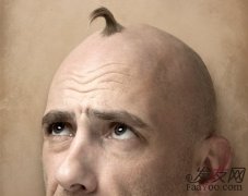 发际线高植发有用吗？