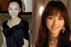 面对捉急的发际线，我们怎么办？