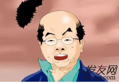 秃顶的时间很久了,还能植发吗?