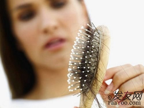 植发应该怎么选择好?你知道吗?