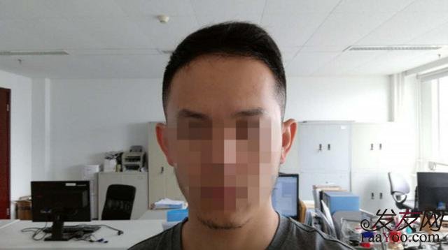 现在过脱落期的我