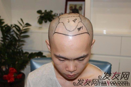 根据适合的发型设计