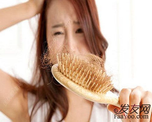 女人脱发用什么洗发水好