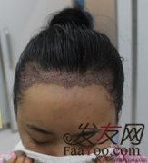 头发又可以见到温暖的阳光了