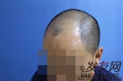 一场抗争，终于要结束了