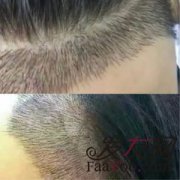 重拾自信，感谢新生