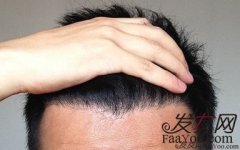 90后，你的头发还好吗？