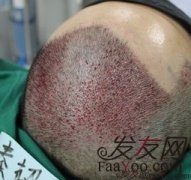 不虚此行，从头开始