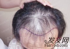 相信自己，蜕变重生