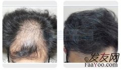 接受不完美的现实，去追求更好的自己