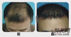 等着我的长发飘飘