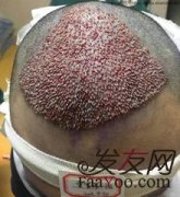 光阴似箭，我又做回了当初的自己