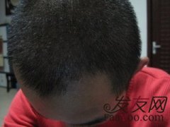 一切都正朝着好的方向发展