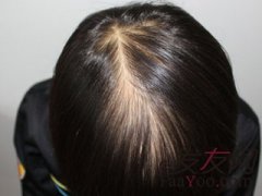 光头对我情有独钟