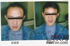 人生的转折往往就在一瞬间