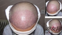 时间真的可以改变一切