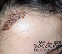 终于摆脱“恶魔角”