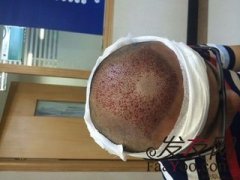 摆脱内心深处的苦恼，在社交上能够自信地抬头