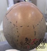 完成植发，完成心愿