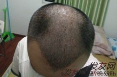 即使已经无力回天了，也不能放弃自救的希望