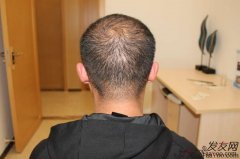 心路历程，实在波折