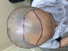 马上要放弃的时候，迎来了人生中的转机