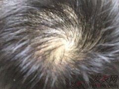 人生到处都是意外和惊喜