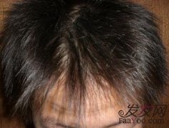 经历一波三折，终于可以安心上学了