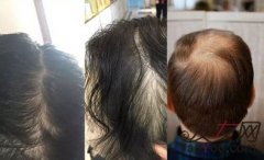 一件小小的事情，竟有如此大的转变