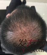 有时无心胜有心