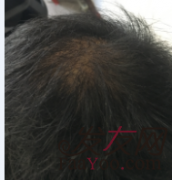 不经意间迎来的转机