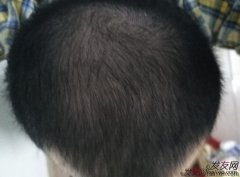 满头乌黑秀发原来这么简单