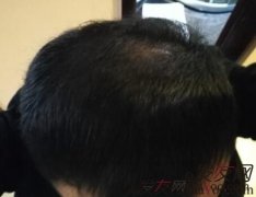 在等待奇迹出现的那一天