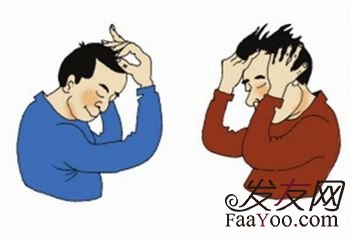 脱发是什么?治疗的方法有什么?