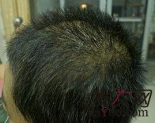 难打理的发型，真是遇到克星了