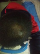 真是飞来横祸，还是打算从新来过