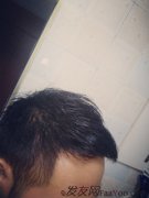 一天天从茂密的森林，变得渐渐稀疏