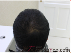 虽然第一次的造型不完美，但发量已经让自己惊喜了